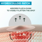 Garnier Skin Active Fast Clear 8-Hour Invisible Pimple Patch Hydrocolloid